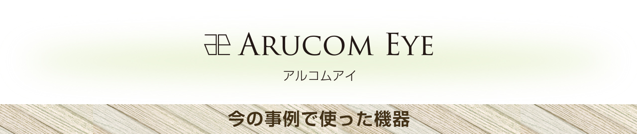 アルコムアイ、紹介した事例で使った機器